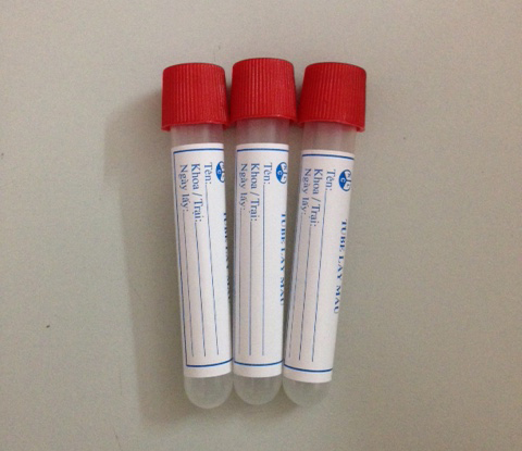 Dự án tiêu biểu